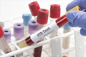 STD Test